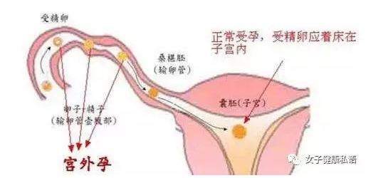 天津津南松山区去哪家医院检查宫外孕更具准确性